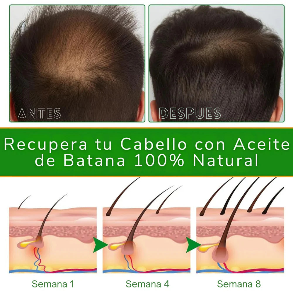 2 x1 Batana Oil 100% Puro 🌿 | Crecimiento Capilar Antialopecia